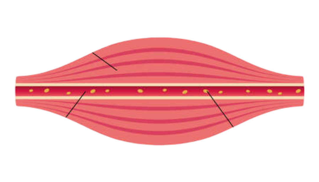 Nachher: entspannteres Gefühl