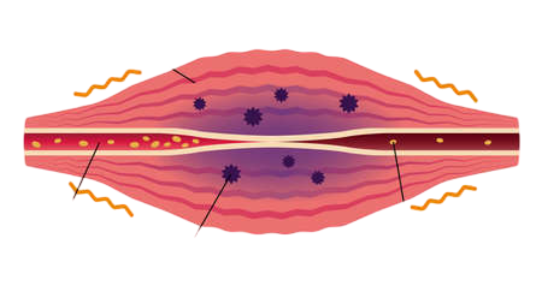 Vorher: angespanntes Gefühl